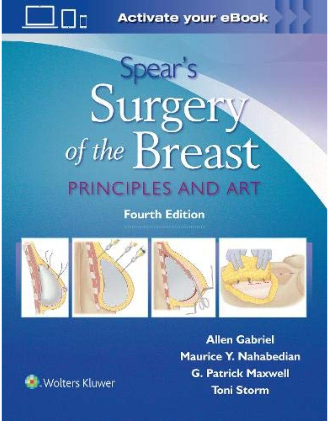 Spear’s Surgery of the Breast Principles and Art, Fourth edition
