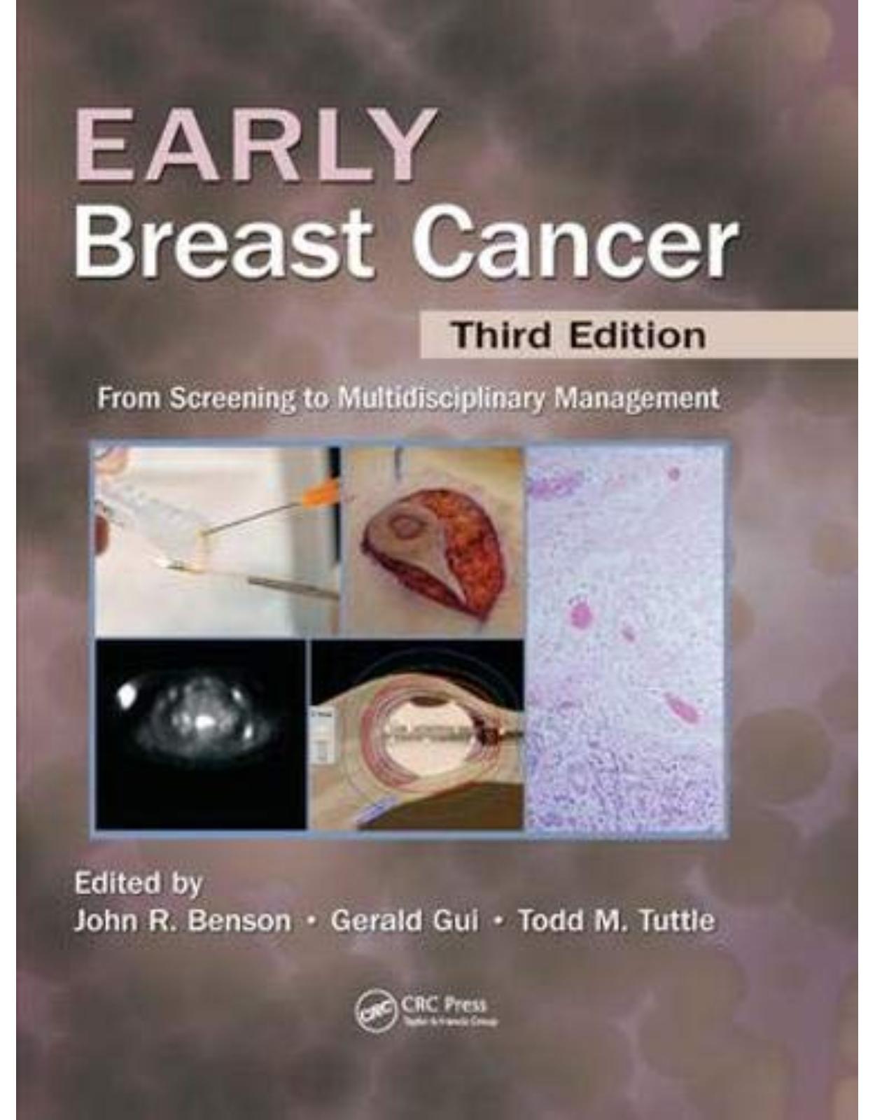 Early Breast Cancer. From Screening to Multidisciplinary Management, Third Edition