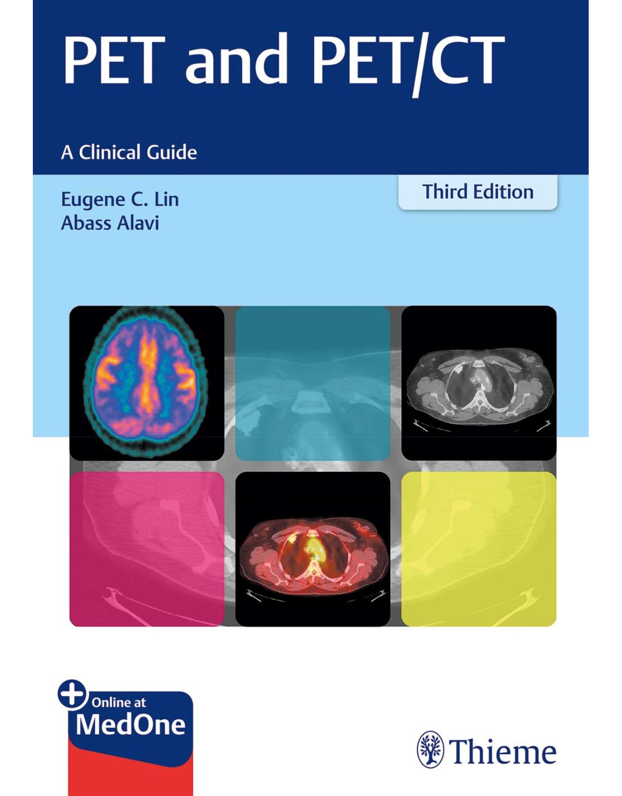 PET and PET/CT. A Clinical Guide