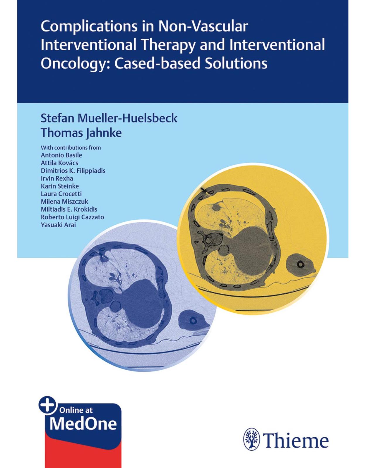 Complications in Non-vascular Interventional Therapy and Interventional Oncology: Case-based Solutions