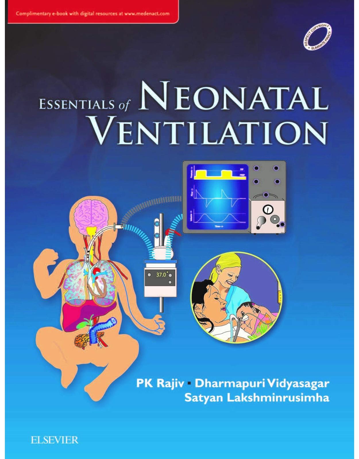 Essentials of Neonatal Ventilation, 1st edition