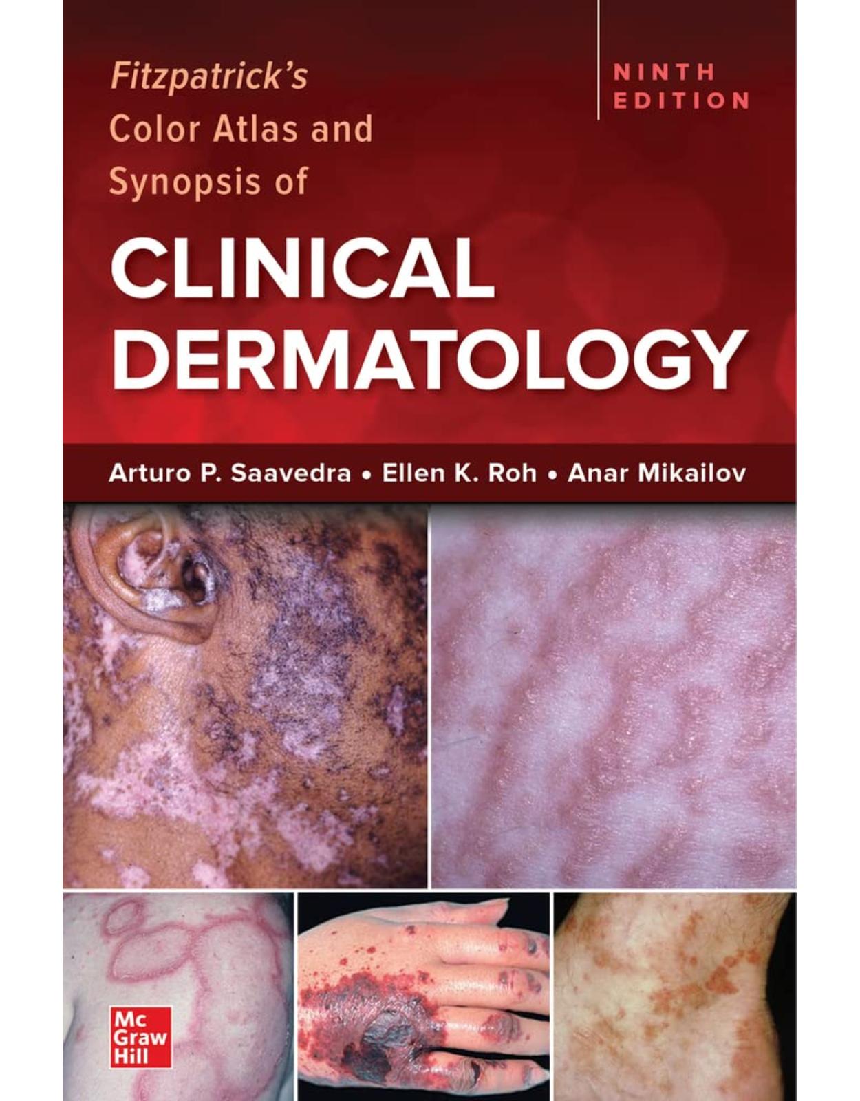 Fitzpatrick’s Color Atlas and Synopsis of Clinical Dermatology