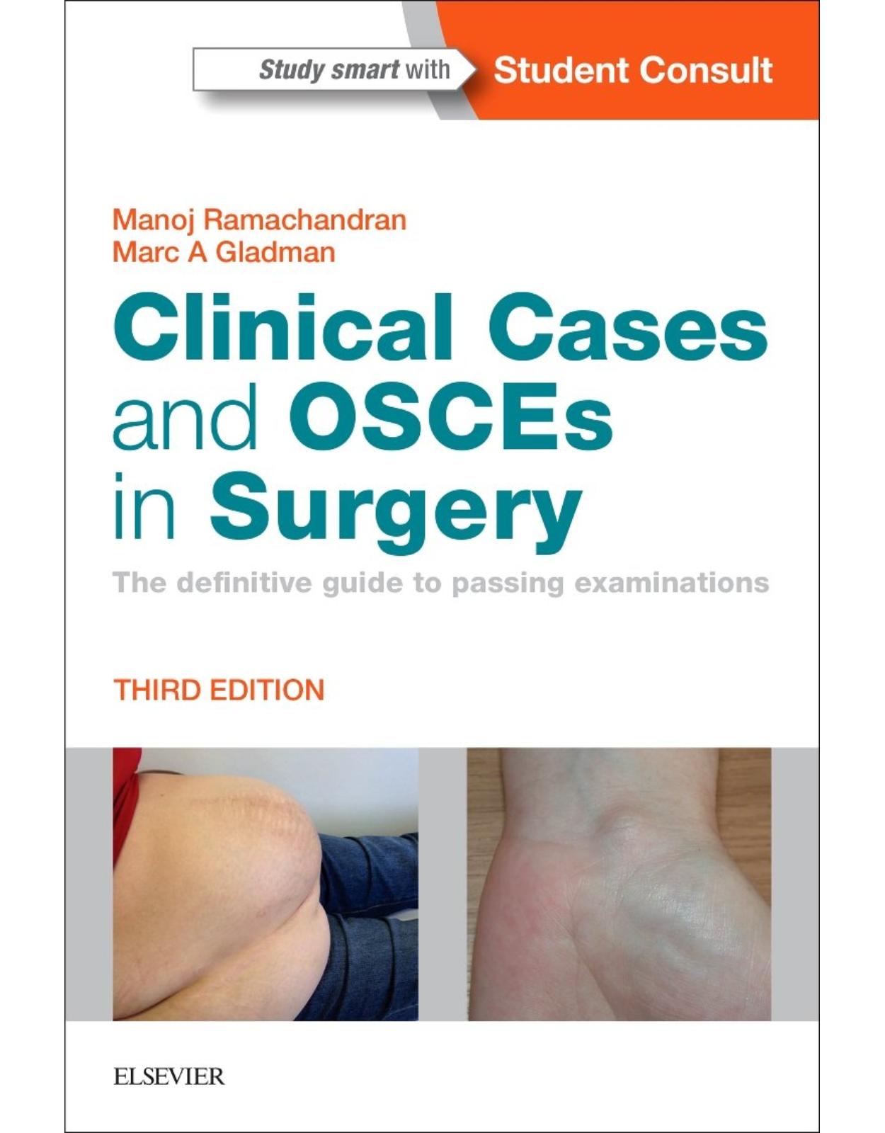 Clinical Cases and OSCEs in Surgery: The definitive guide to passing examinations, 3e
