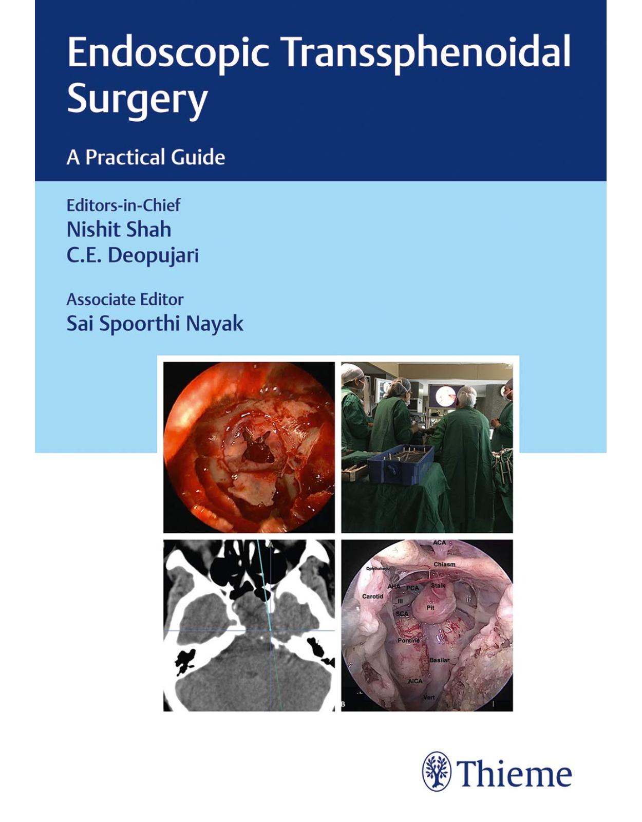 Endoscopic Transsphenoidal Surgery: A Practical Guide