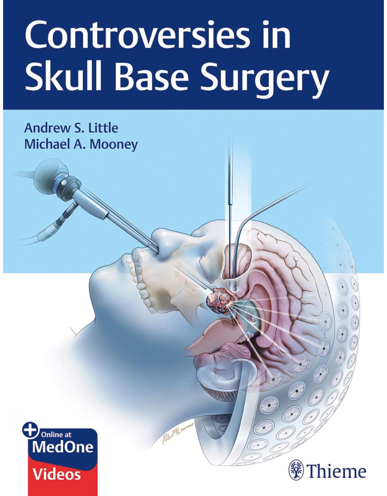 Controversies in Skull Base Surgery