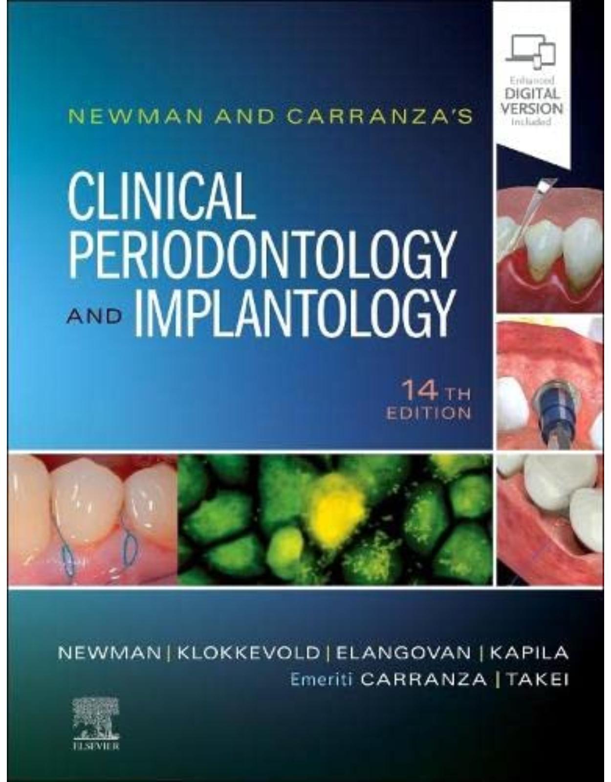 Newman and Carranza’s Clinical Periodontology and Implantology