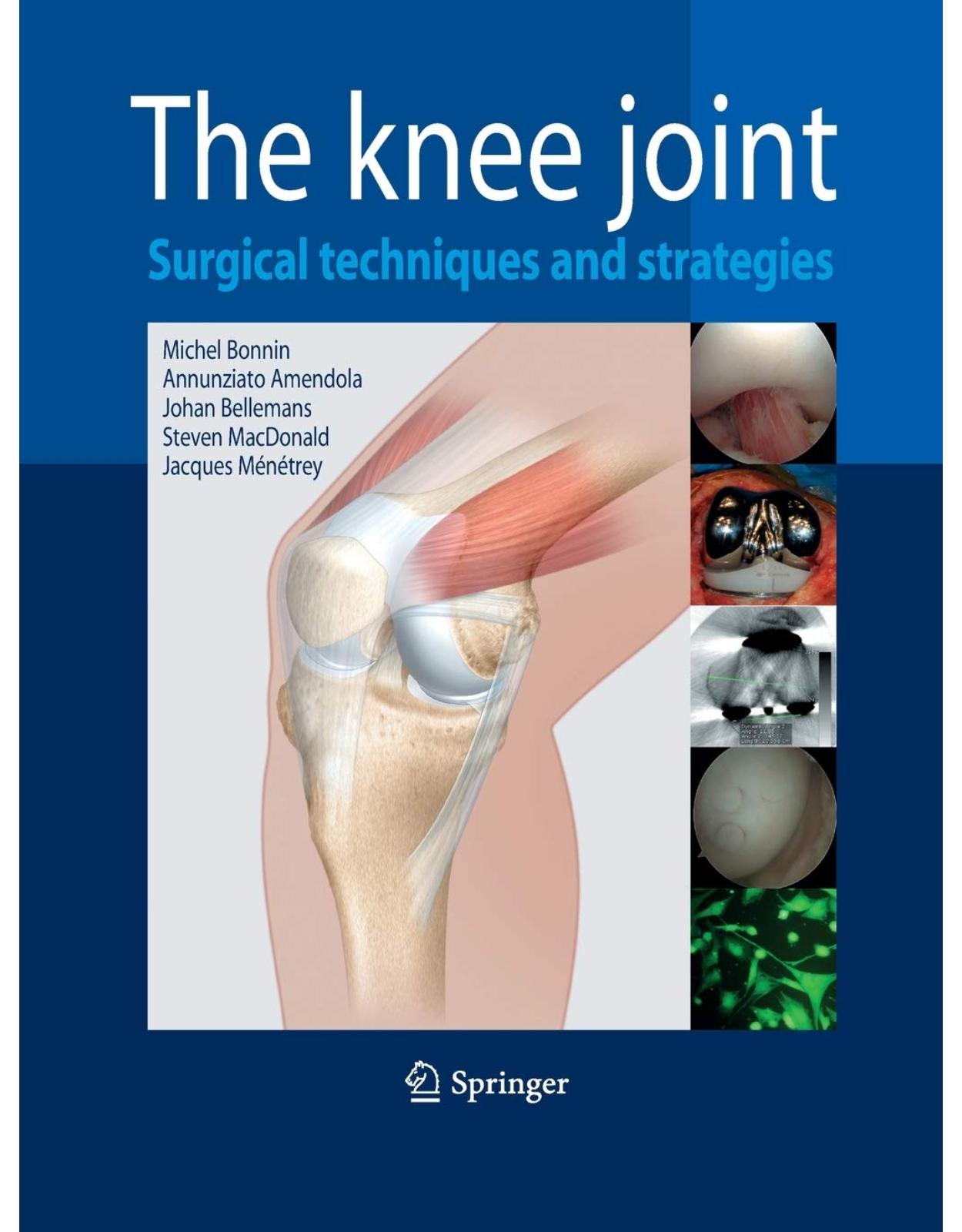 The Knee Joint: Surgical Techniques and Strategies