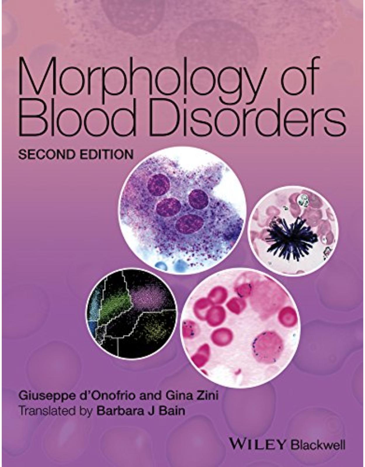 Morphology of Blood Disorders 2e