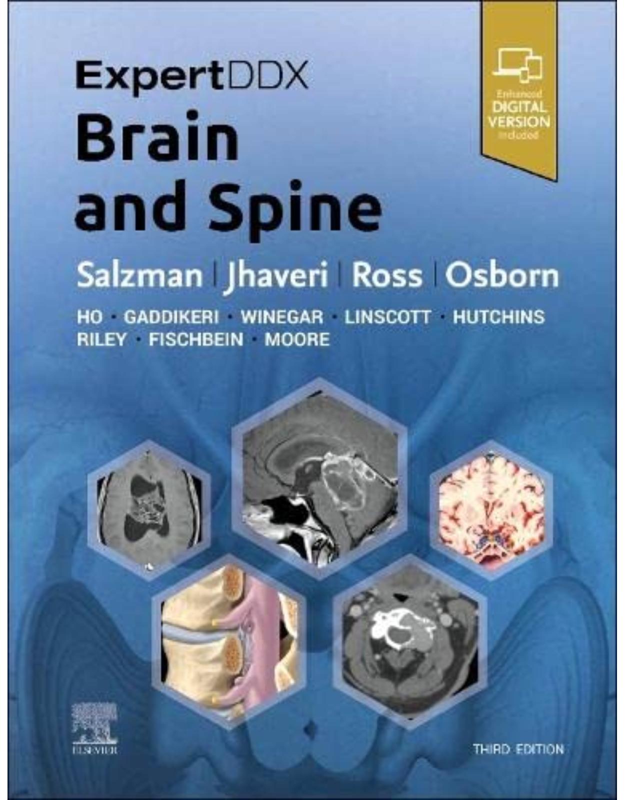 ExpertDDx: Brain and Spine 