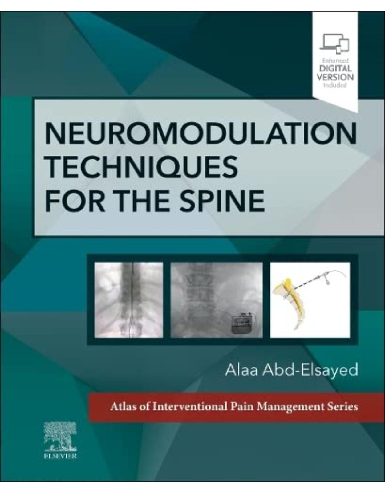 Neuromodulation Techniques for the Spine