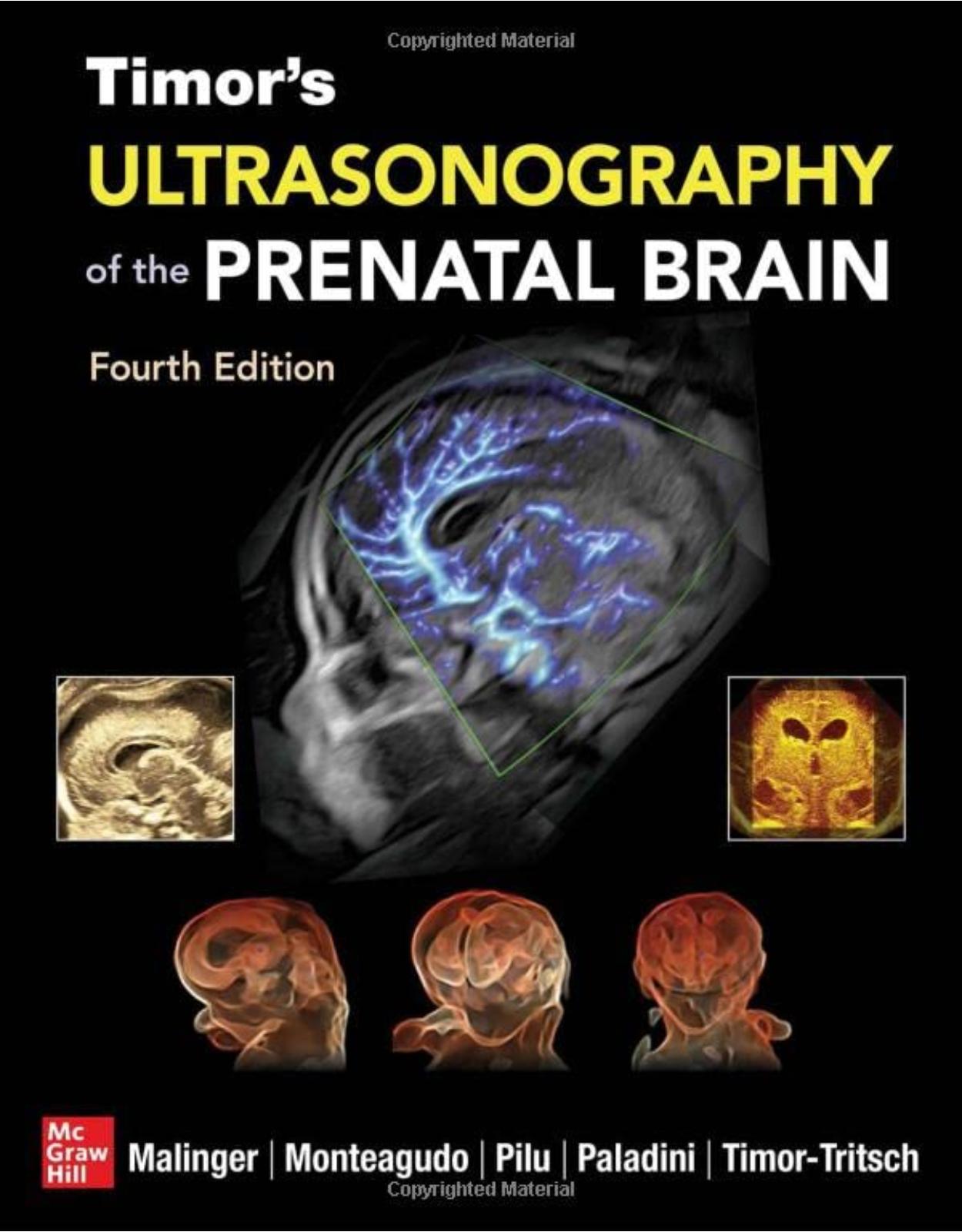 Timor’s Ultrasonography of the Prenatal Brain, Fourth Edition