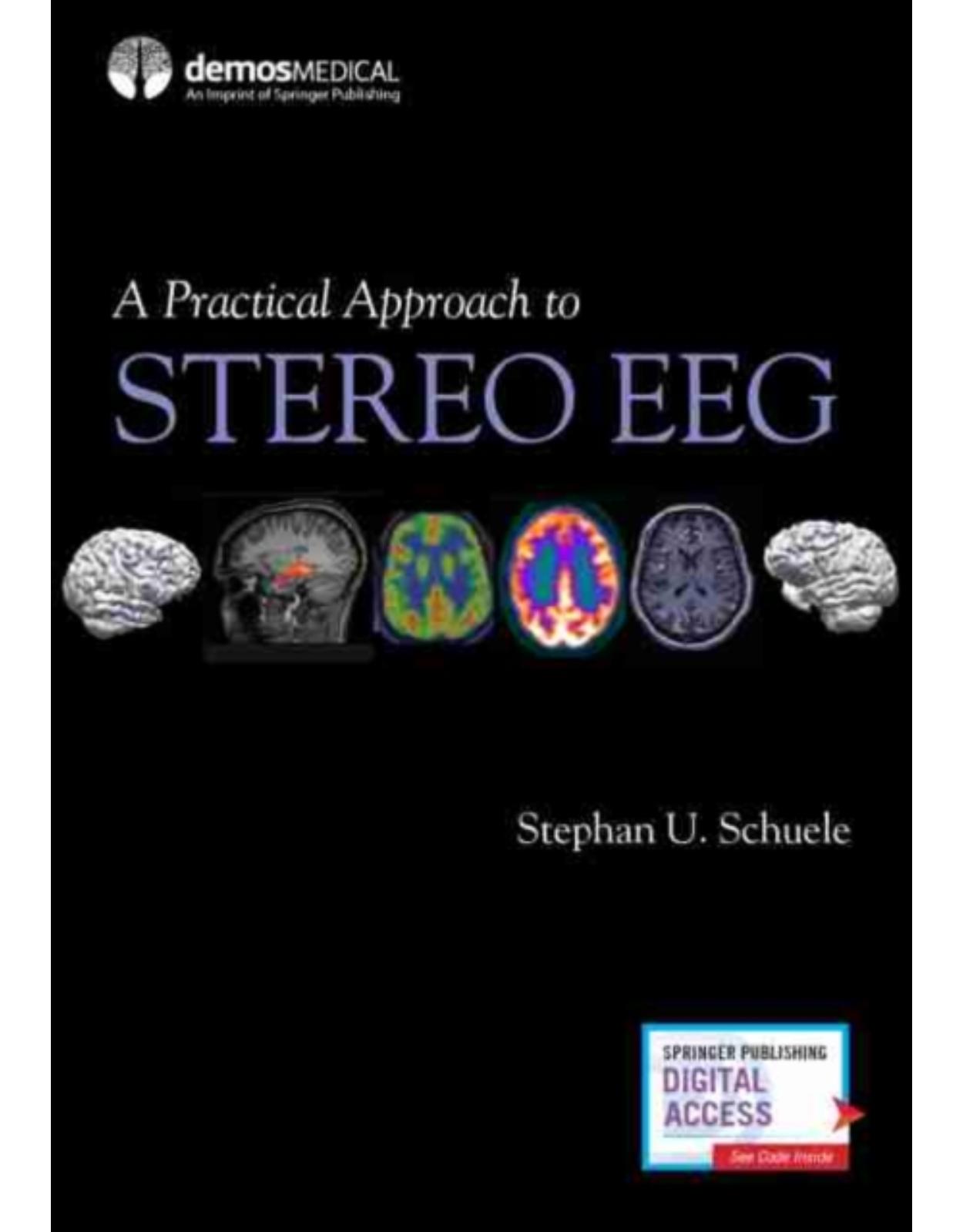 A Practical Approach to Stereo Eeg