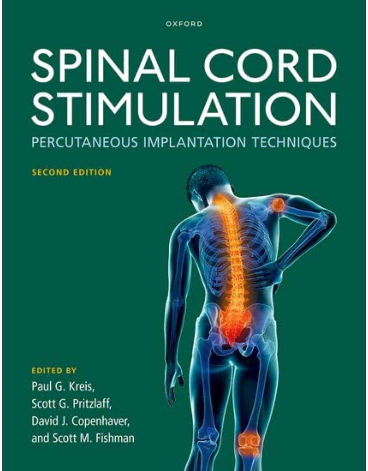 Spinal Cord Stimulation: Percutaneous Implantation Techniques