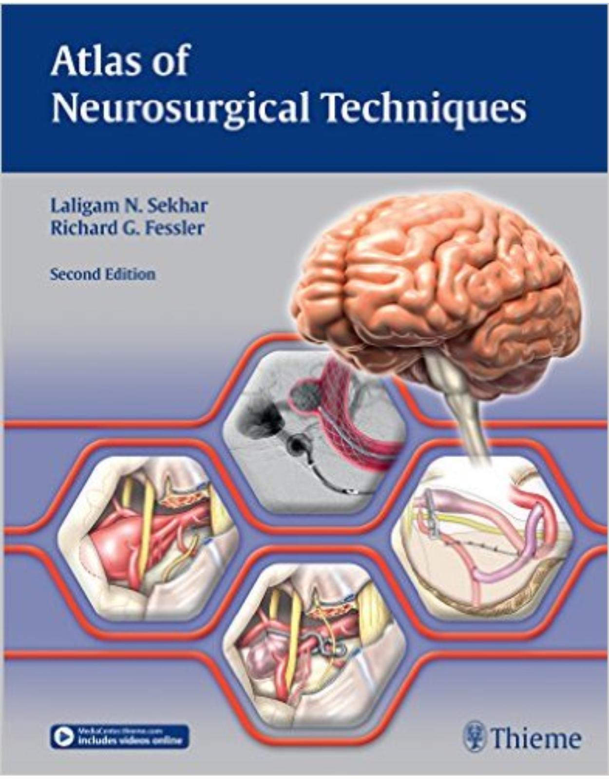 Atlas of Neurosurgical Techniques.Brain.