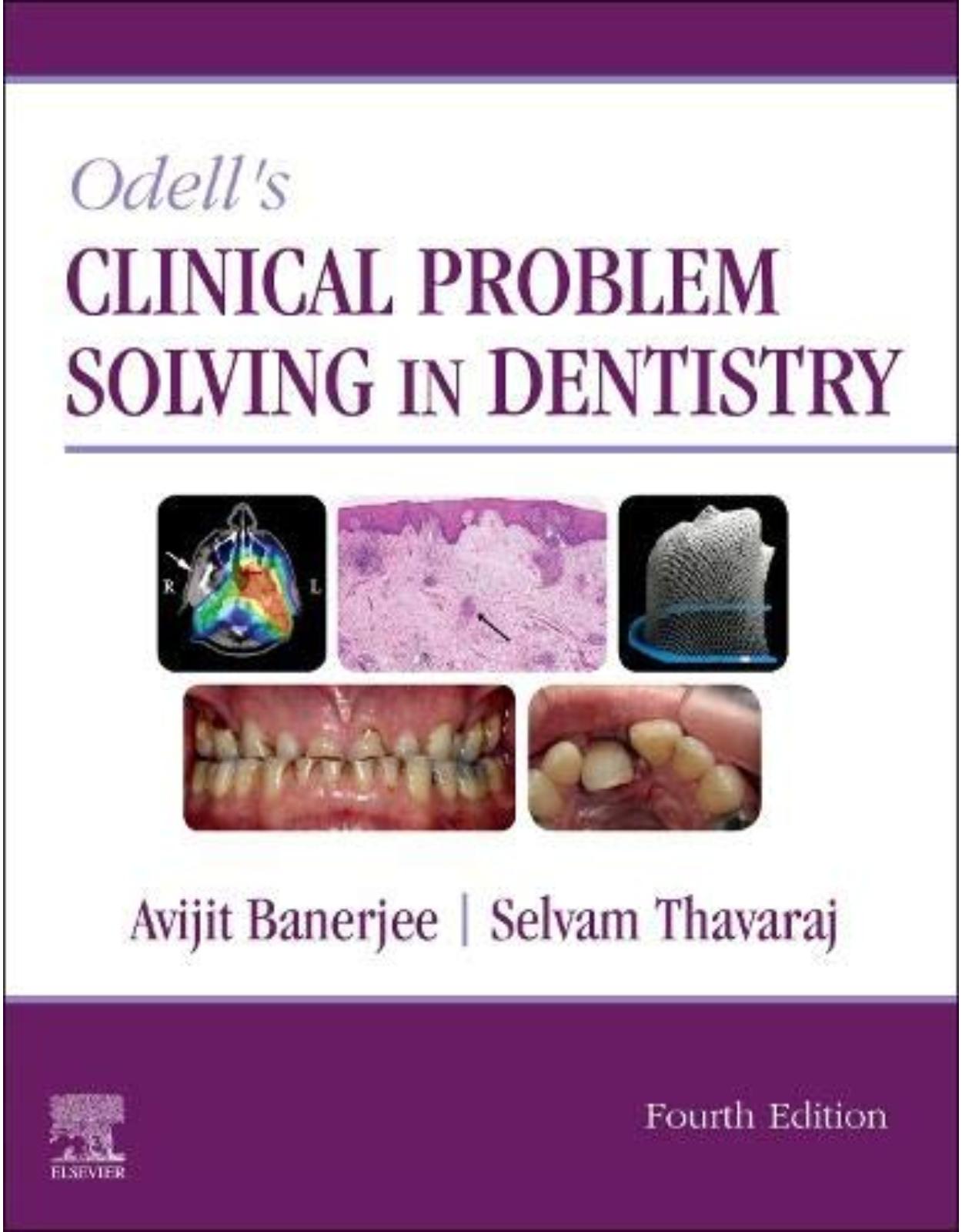 Odell’s Clinical Problem Solving in Dentistry