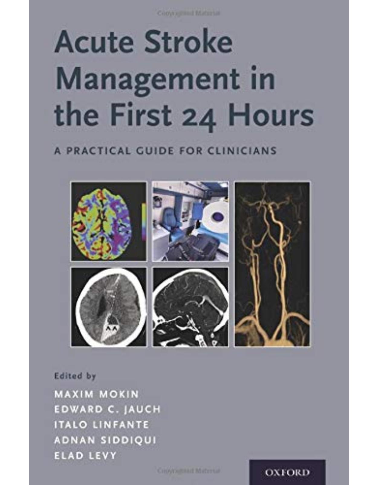 Acute Stroke Management in the First 24 Hours: A Practical Guide for Clinicians 