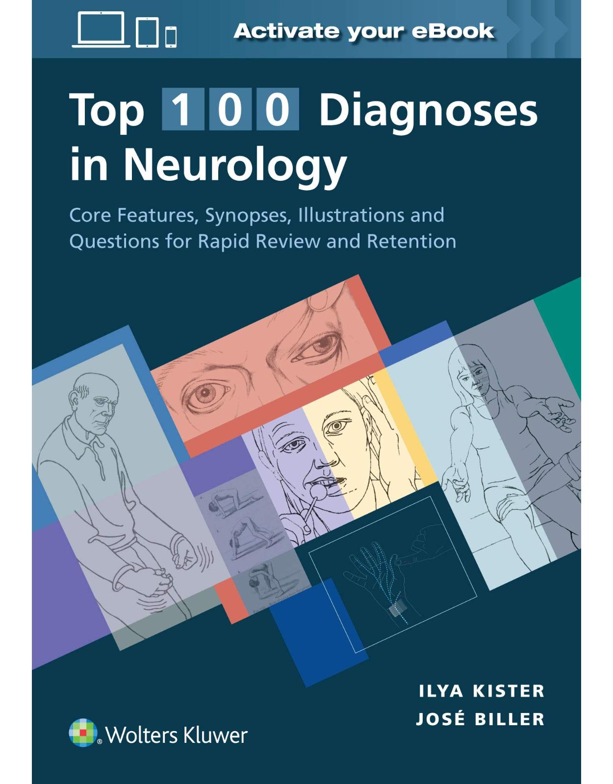 Top 100 Diagnoses in Neurology