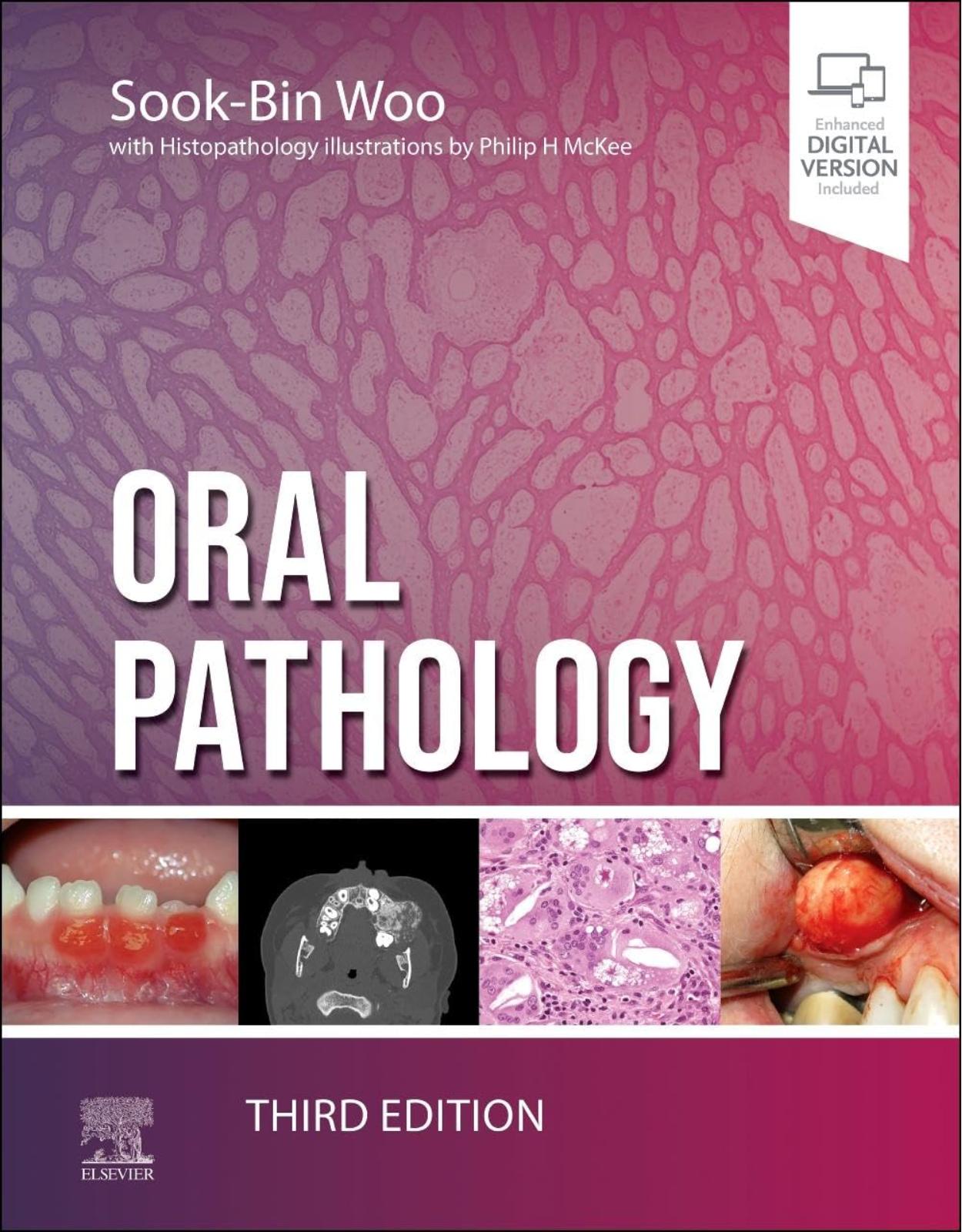 Oral Pathology 