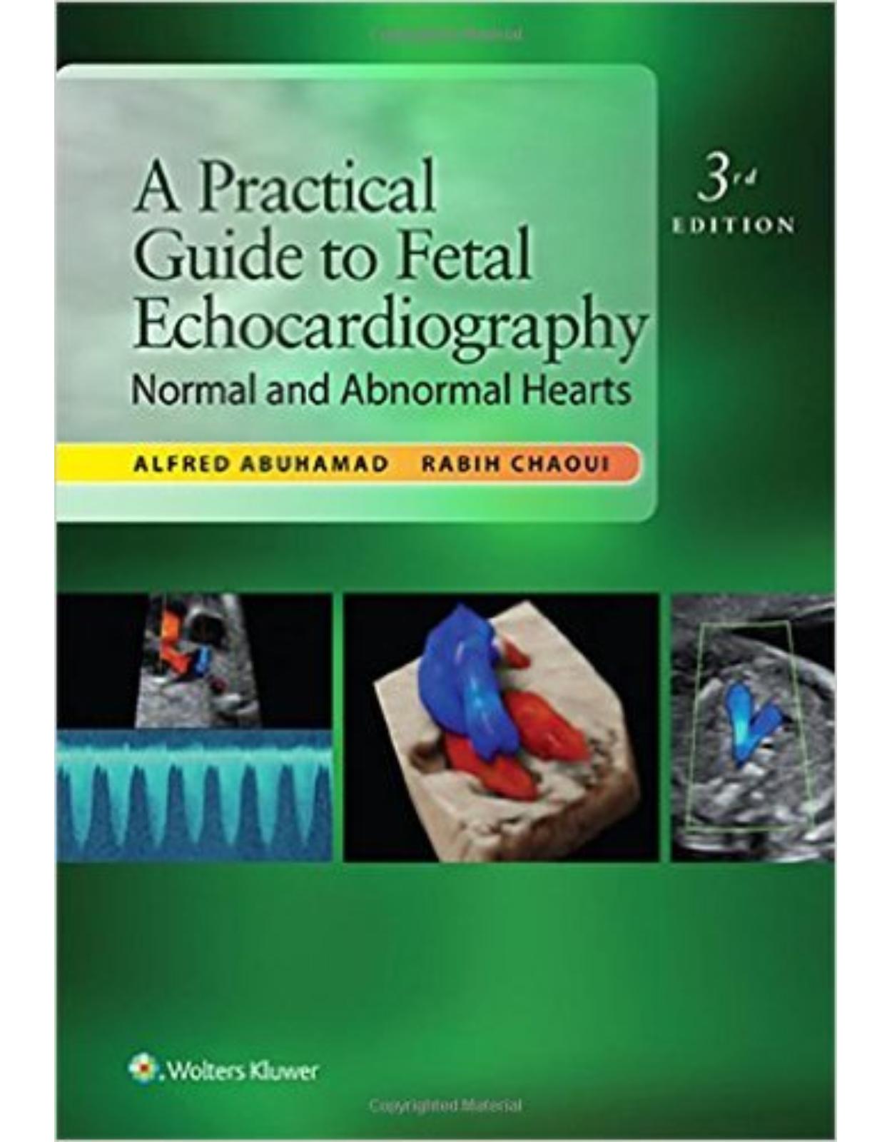 A Practical Guide to Fetal Echocardiography