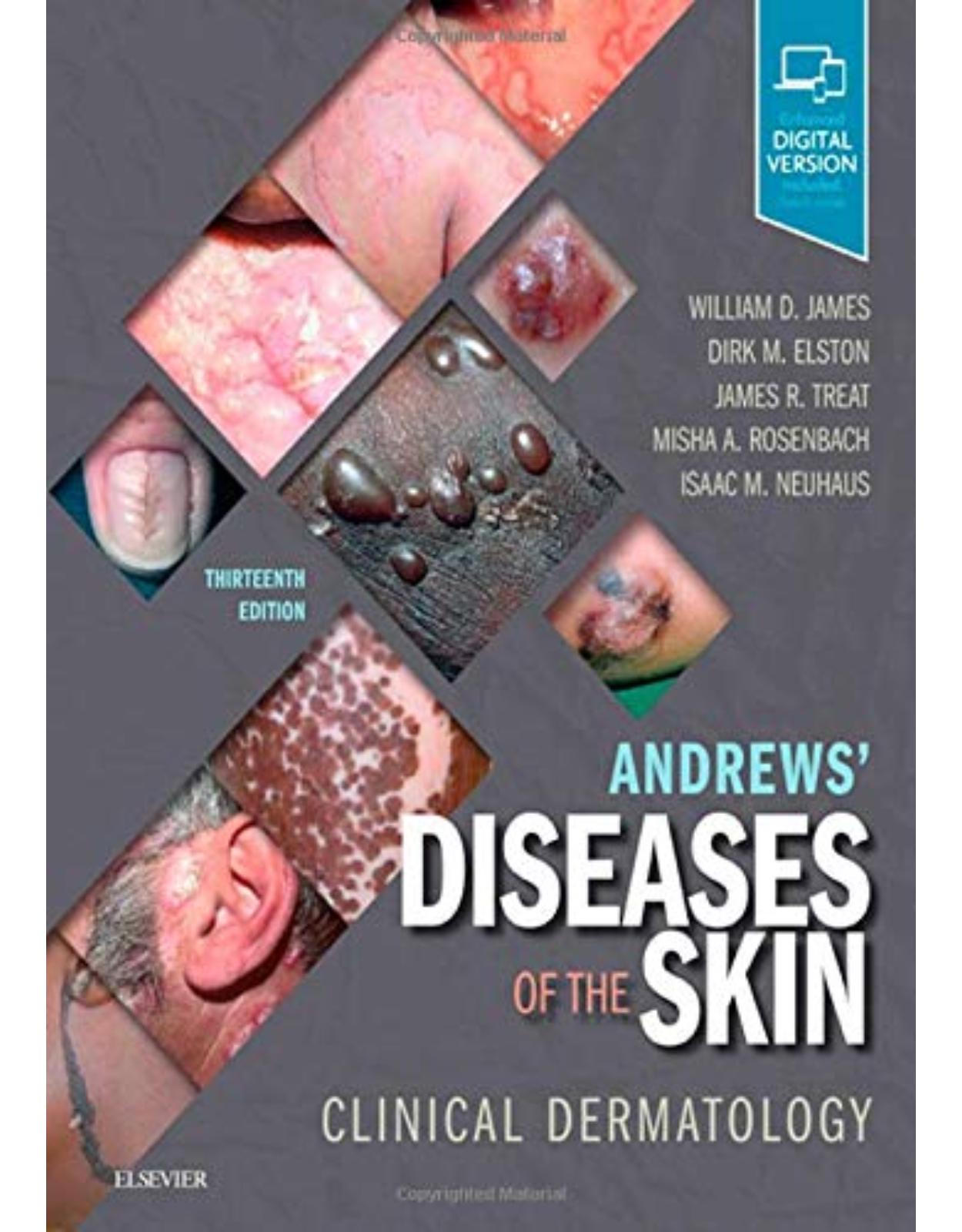 Andrews’ Diseases of the Skin: Clinical Dermatology, 13e