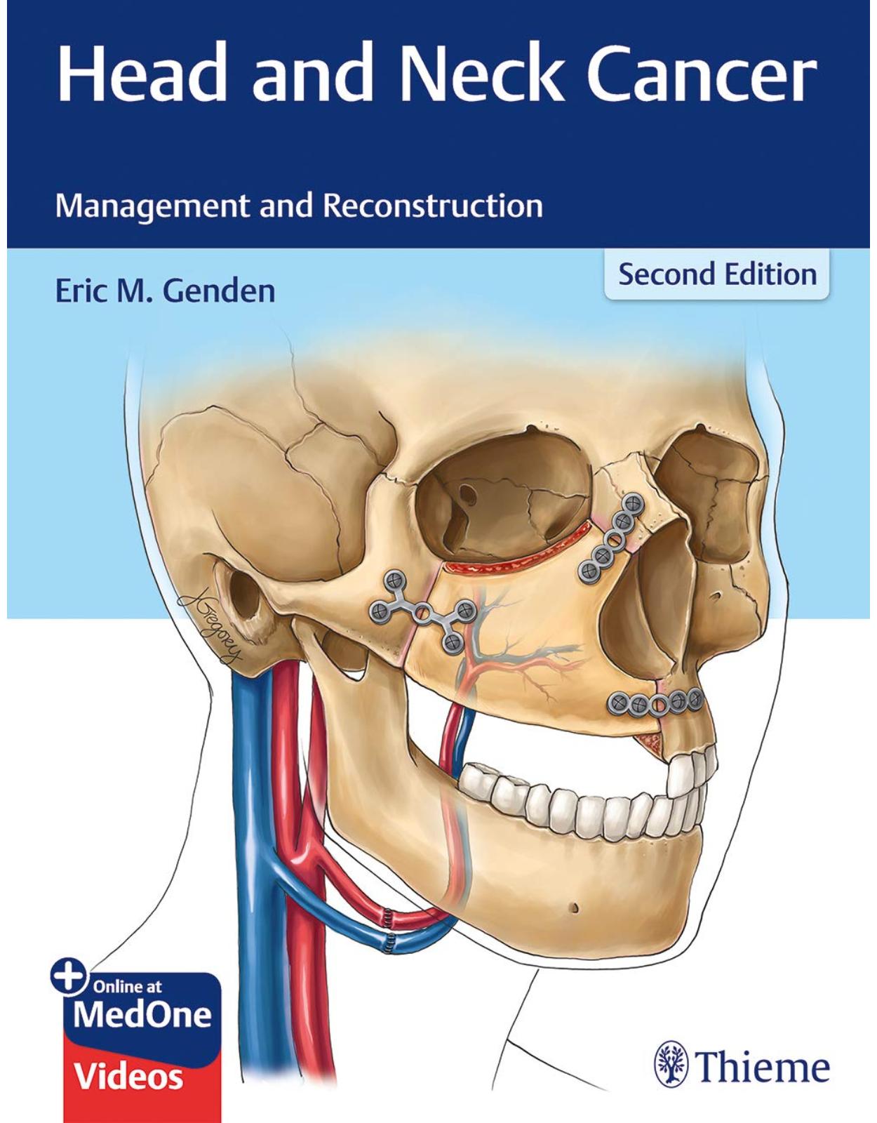 Head and Neck Cancer: Management and Reconstruction