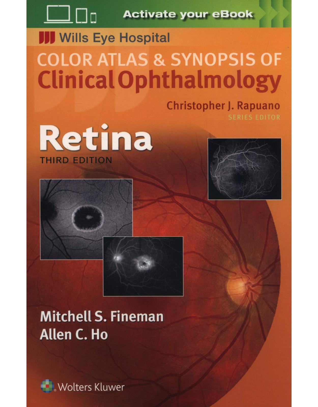 Retina (Color Atlas & Synopsis of Clinical Ophthalmology) 