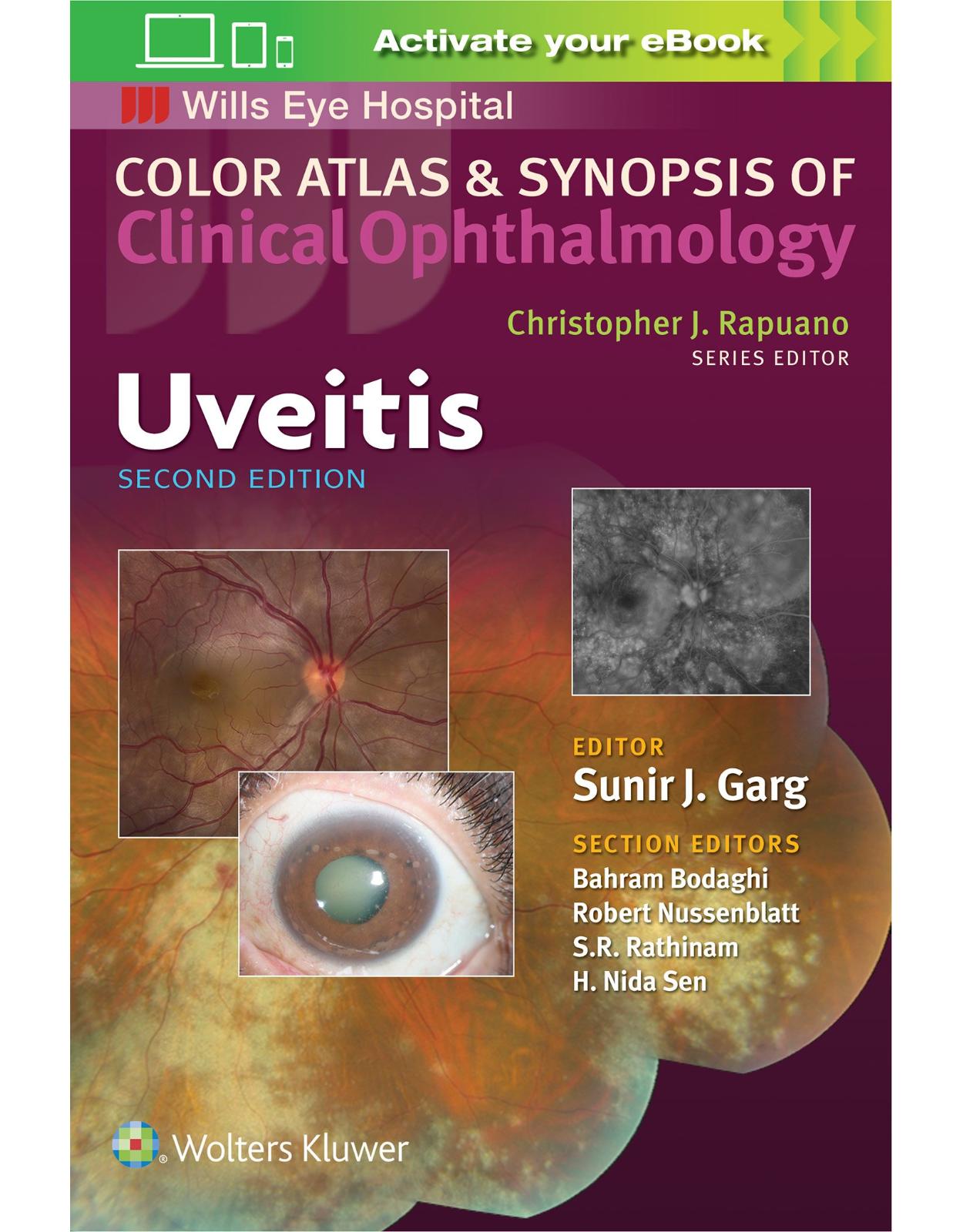 Uveitis (Color Atlas & Synopsis of Clinical Ophthalmology)