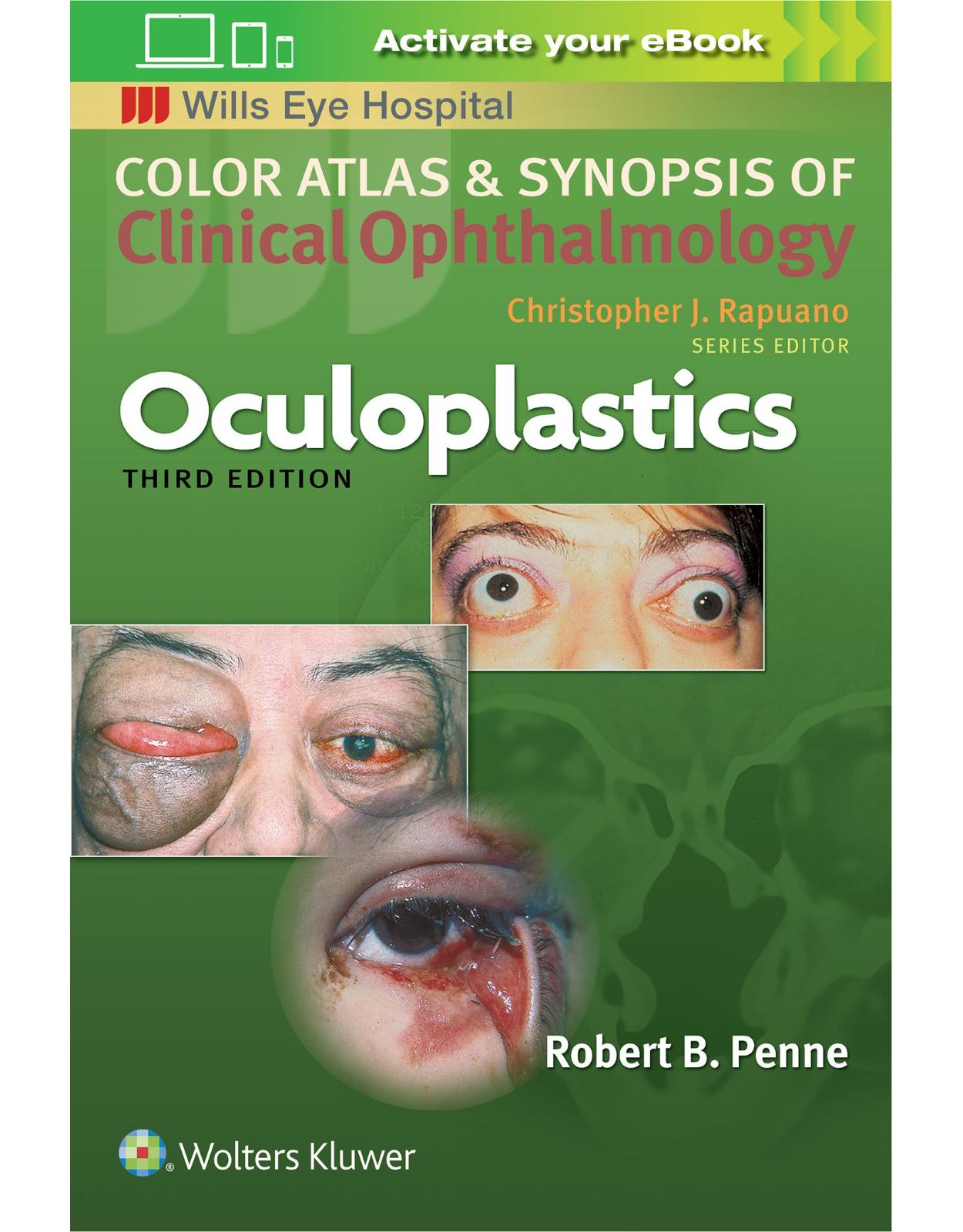 Oculoplastics (Color Atlas & Synopsis of Clinical Ophthalmology)