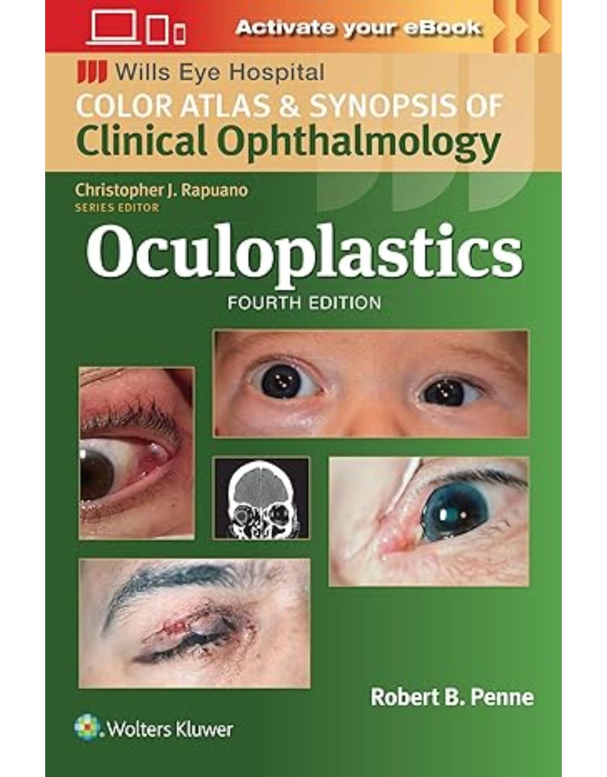 Oculoplastics (Color Atlas & Synopsis of Clinical Ophthalmology)