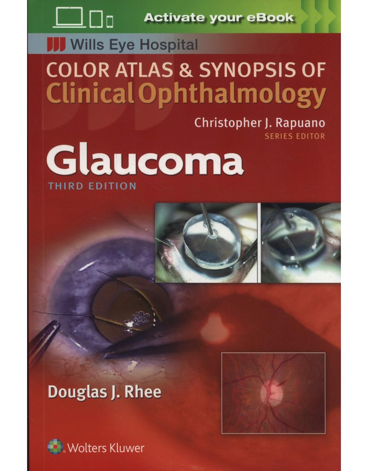 Glaucoma (Color Atlas & Synopsis of Clinical Ophthalmology) 