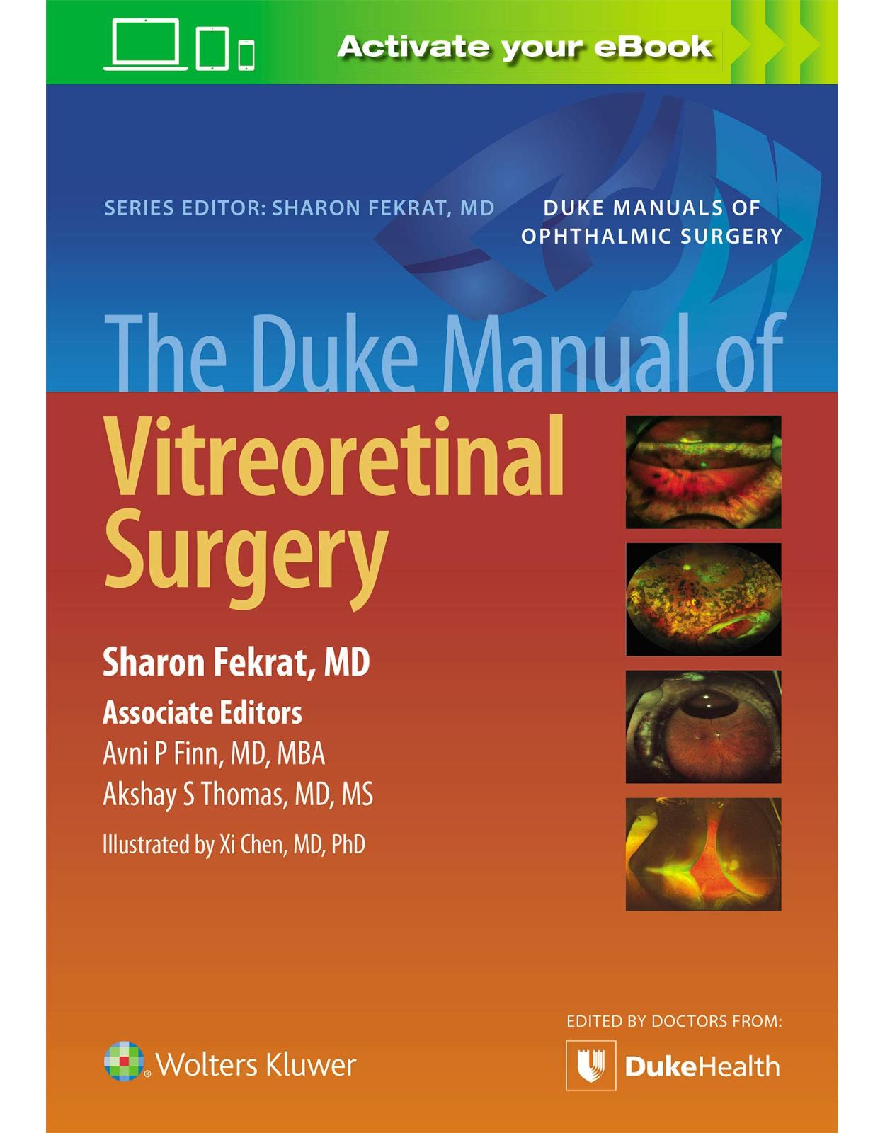 The Duke Manual of Vitreoretinal Surgery 