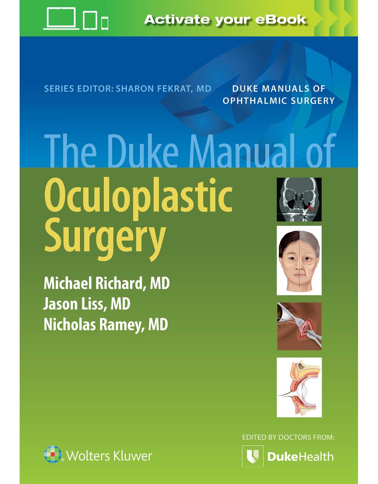 The Duke Manual of Oculoplastic Surgery 