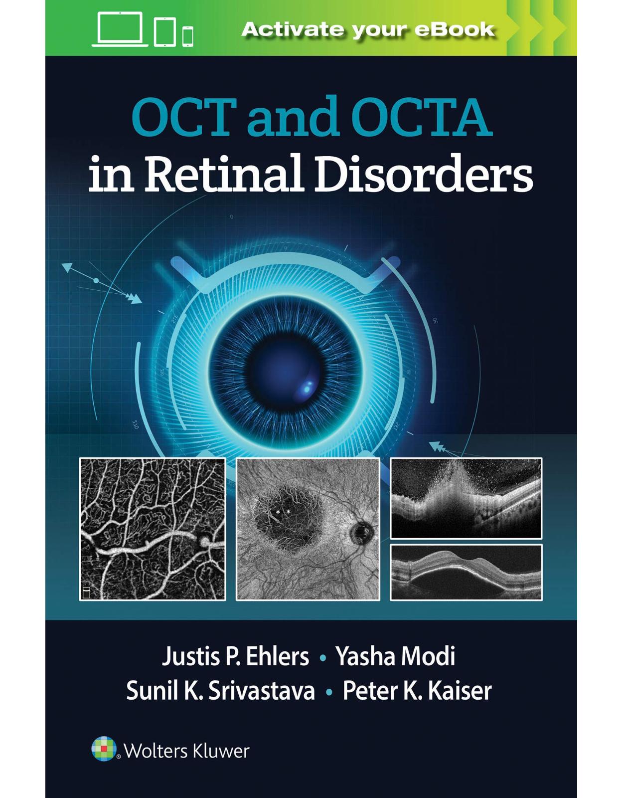 OCT and OCTA Angiography in Retinal Disorders