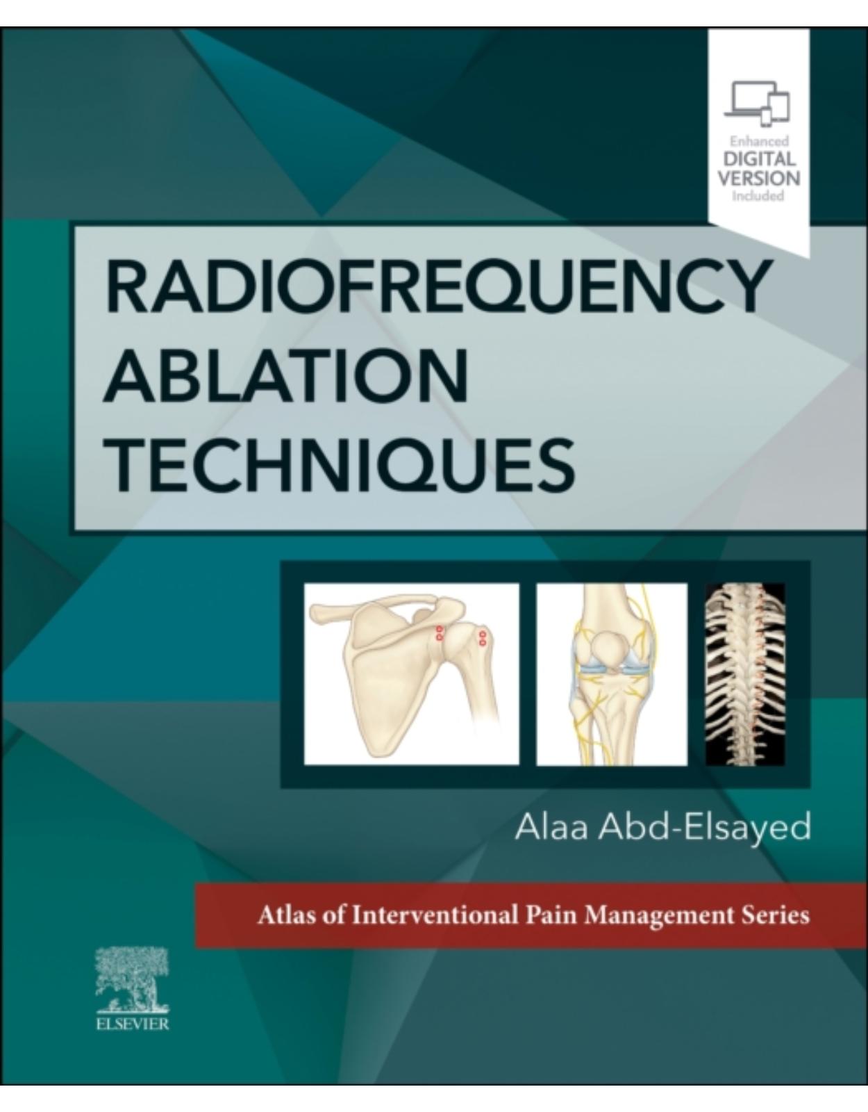 Radiofrequency Ablation Techniques