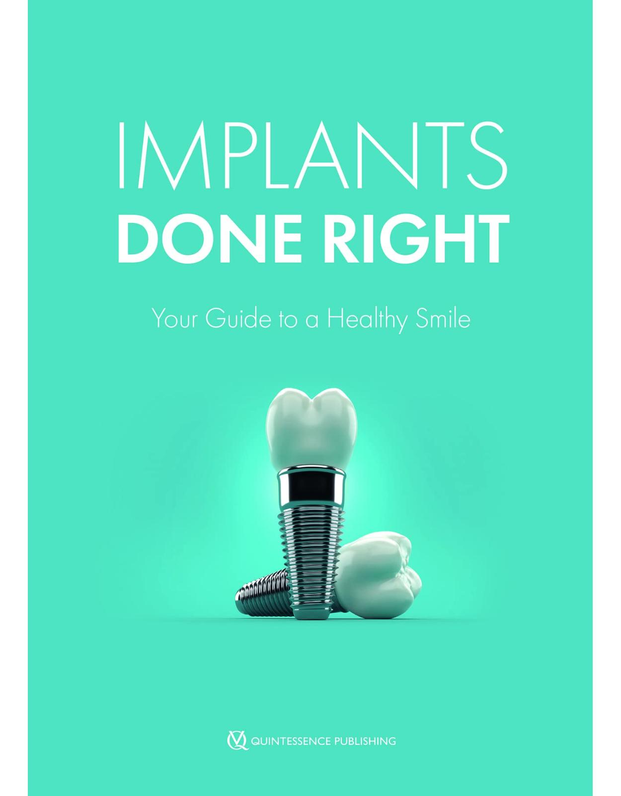 Implants Done Right: Your Guide to a Healthy Smile