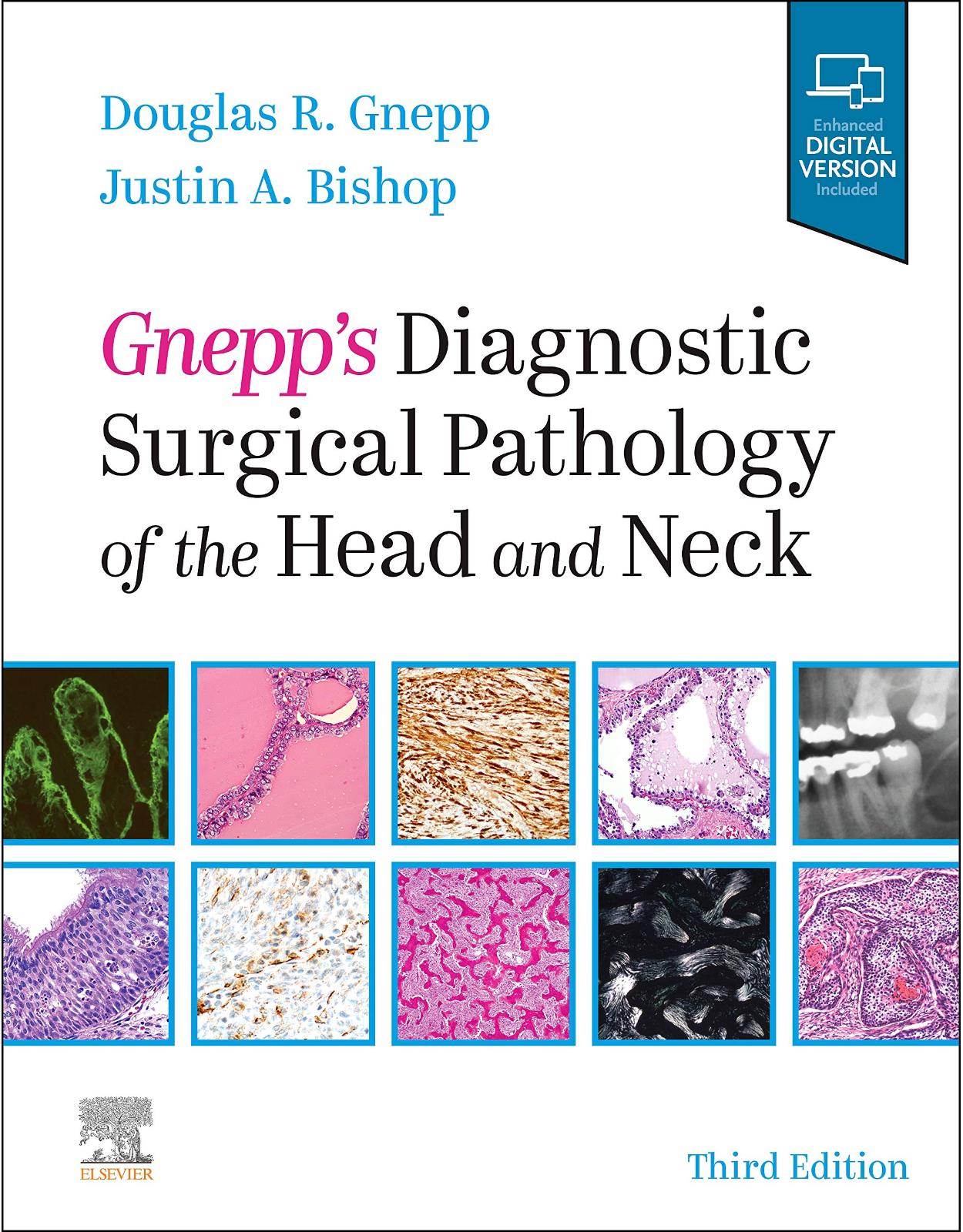 Gnepp's Diagnostic Surgical Pathology of the Head and Neck: Expert Consult - Online and Print
