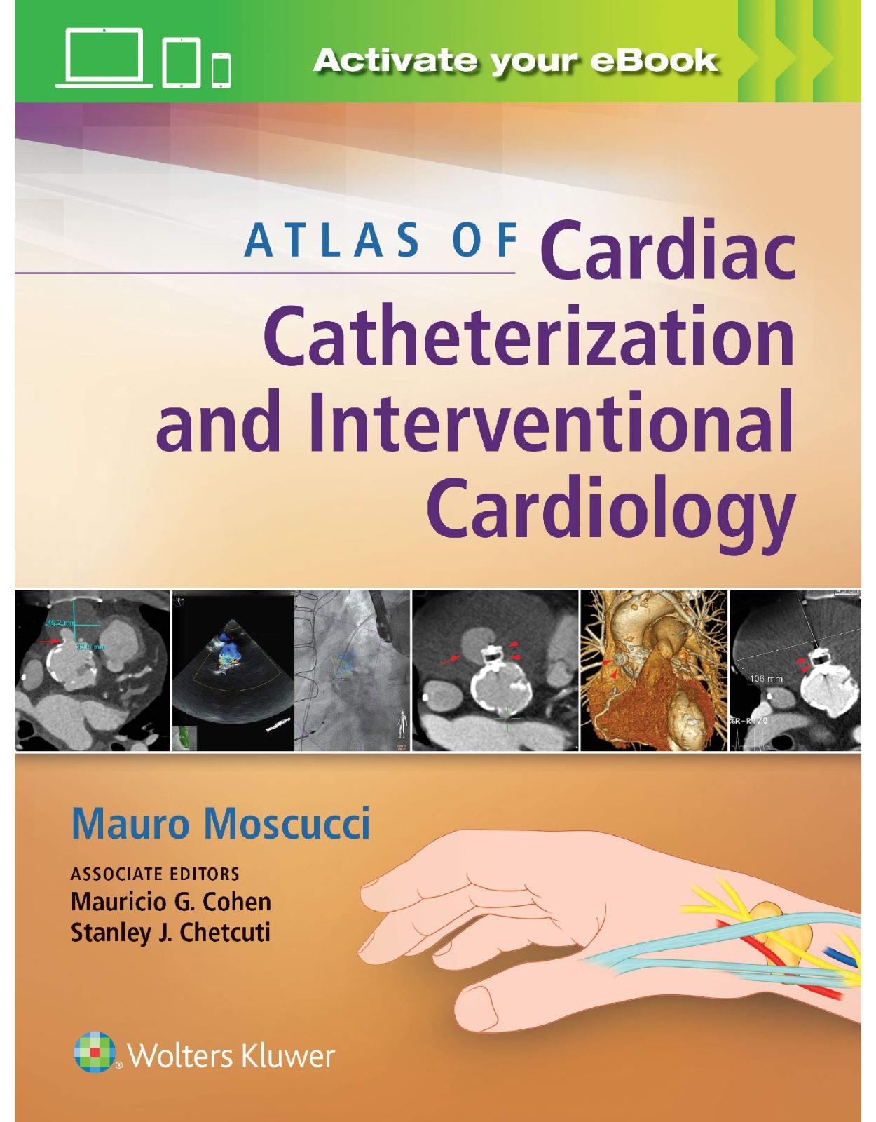 Atlas of Cardiac Catheterization and Interventional Cardiology: Practical Images for Diagnosis and Ablation 