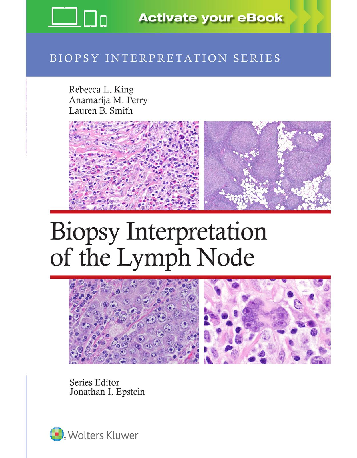 Biopsy Interpretation of the Lymph Node