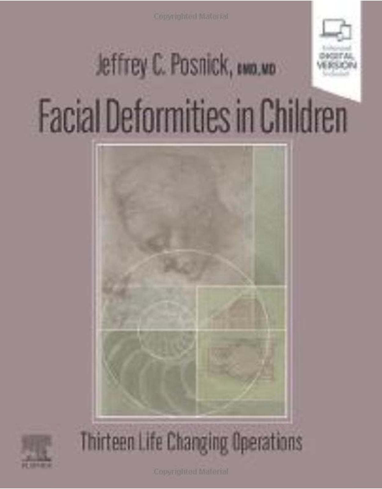 Facial Deformities in Children: Thirteen Life Changing Operations
