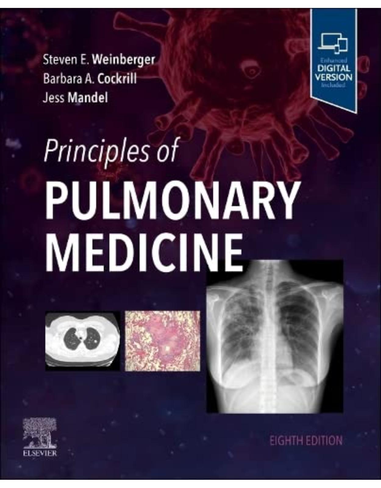 Principles of Pulmonary Medicine