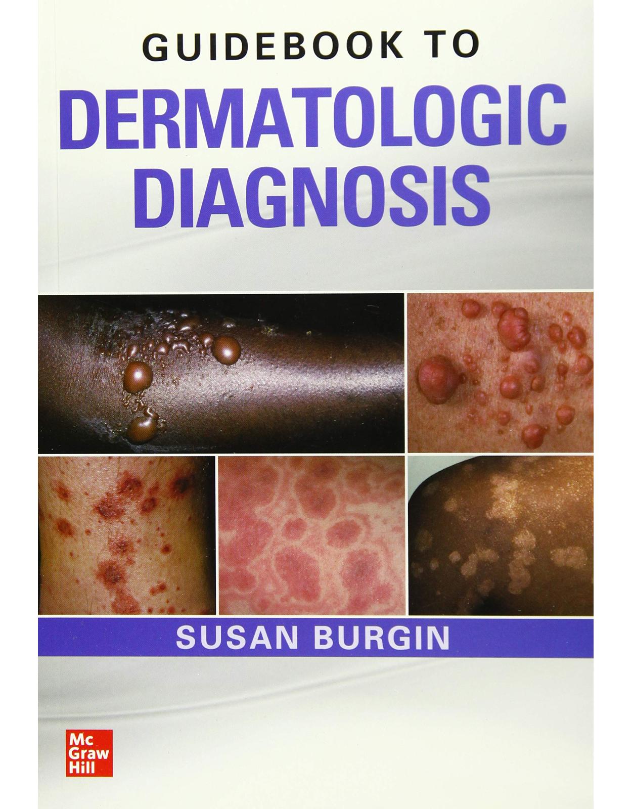 Guidebook to Dermatologic Diagnosis