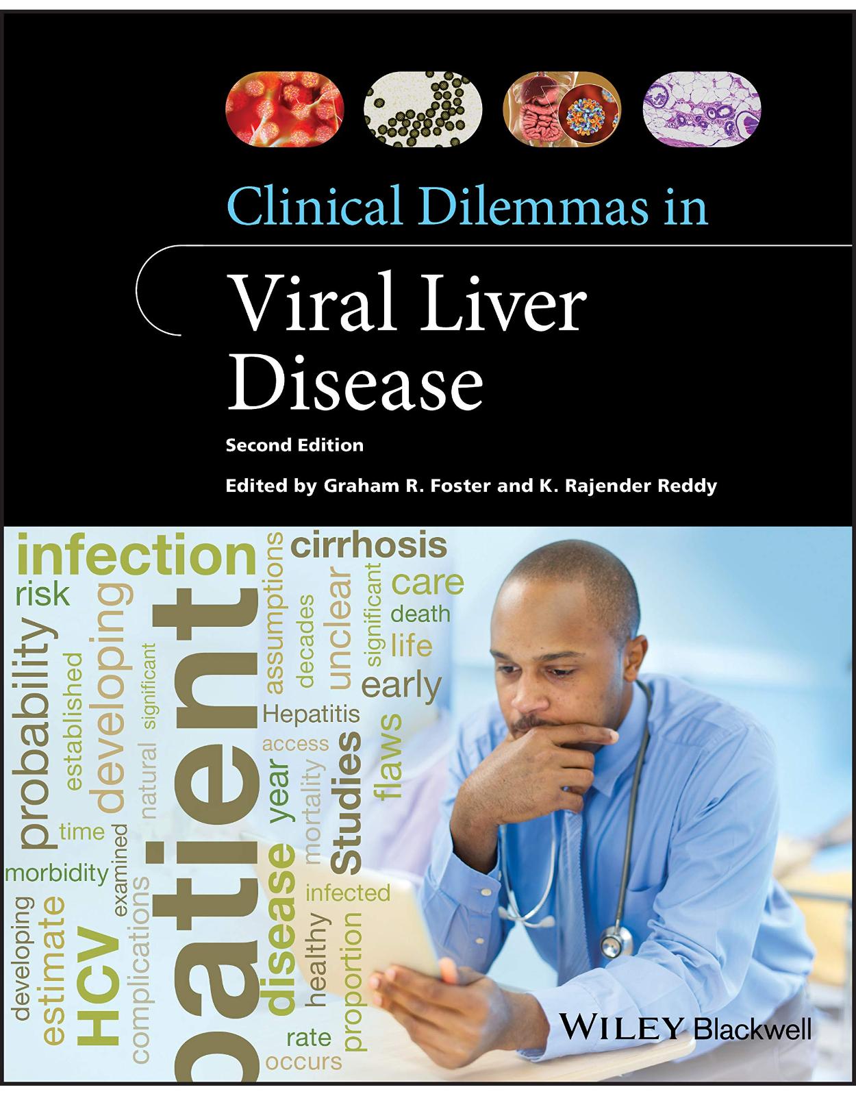 Clinical Dilemmas in Viral Liver Disease