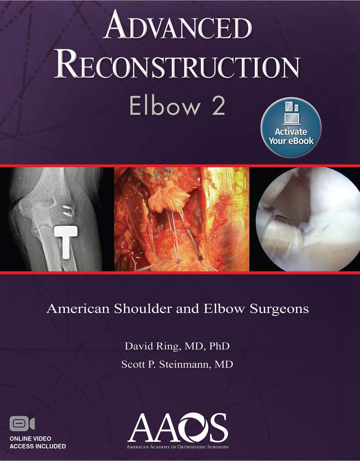 Advanced Reconstruction: Elbow 2: Print with Multimedia. Second edition