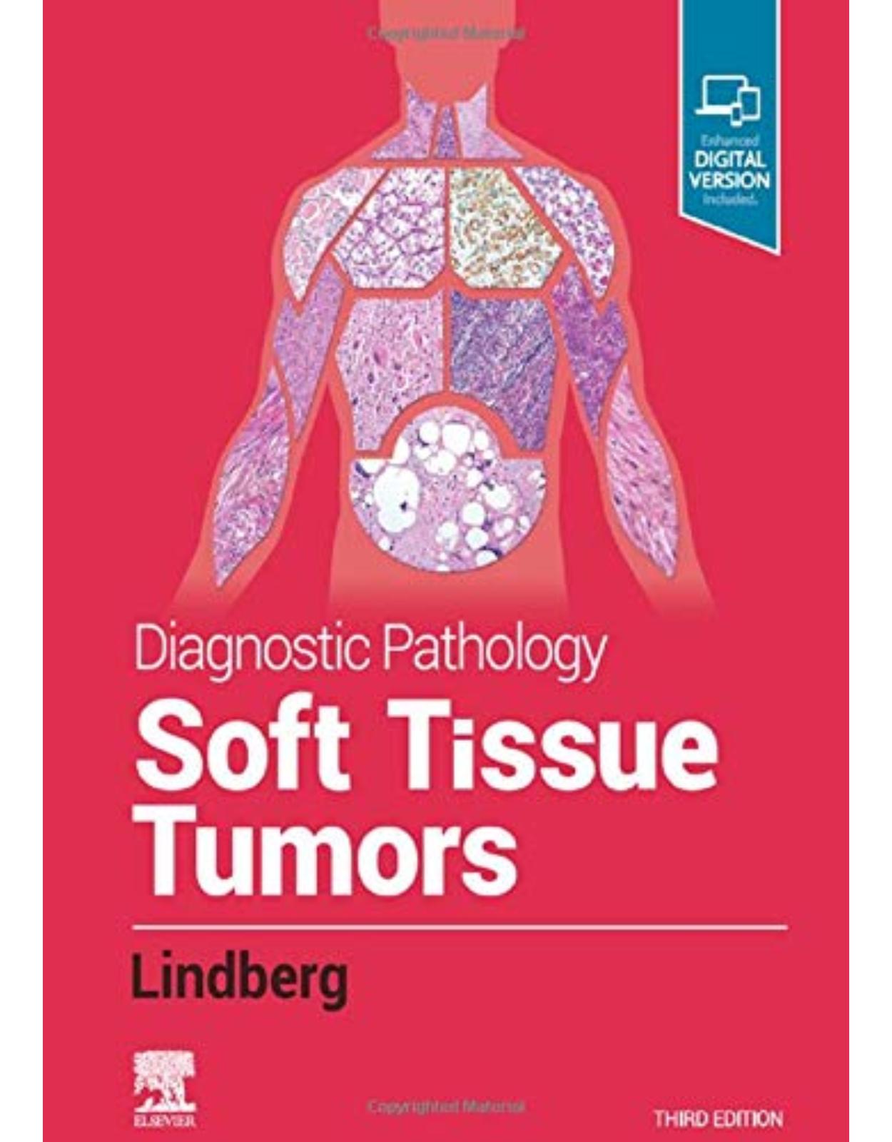 Diagnostic Pathology: Soft Tissue Tumors