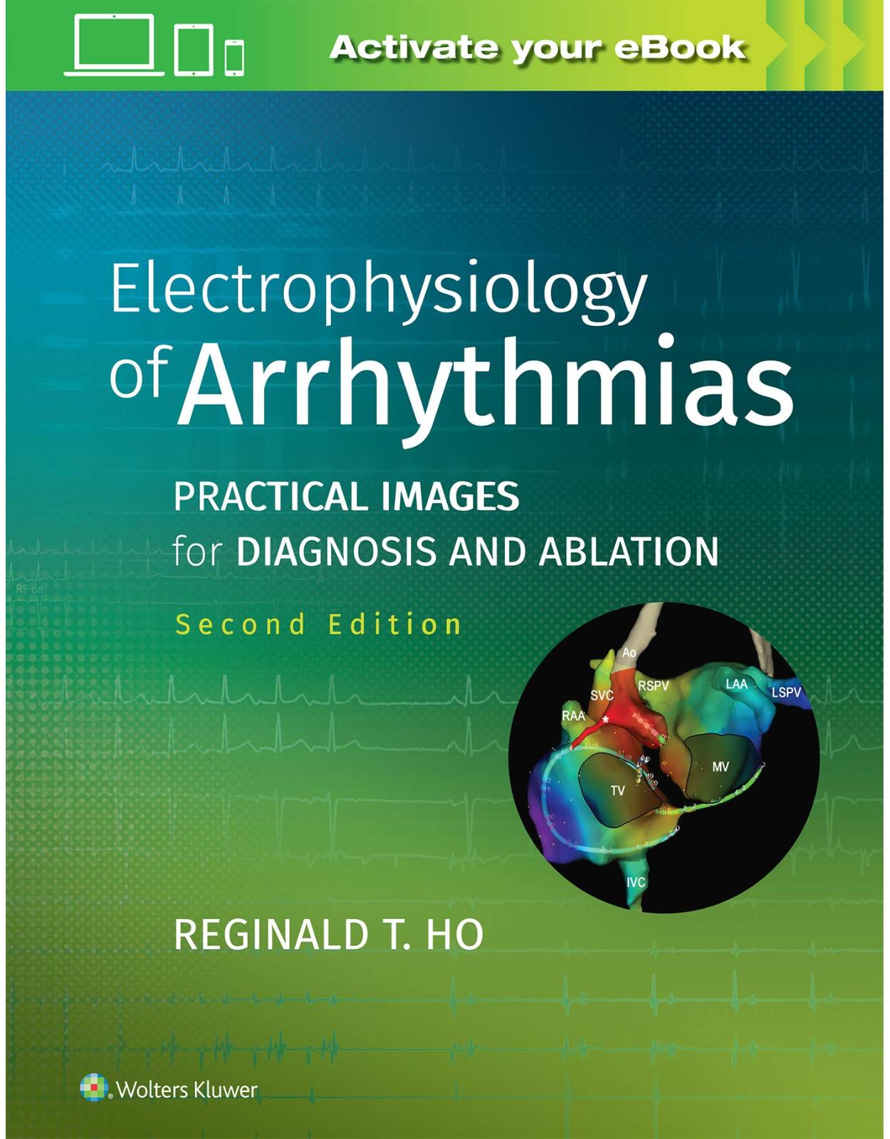 Electrophysiology of Arrhythmias: Practical Images for Diagnosis and Ablation