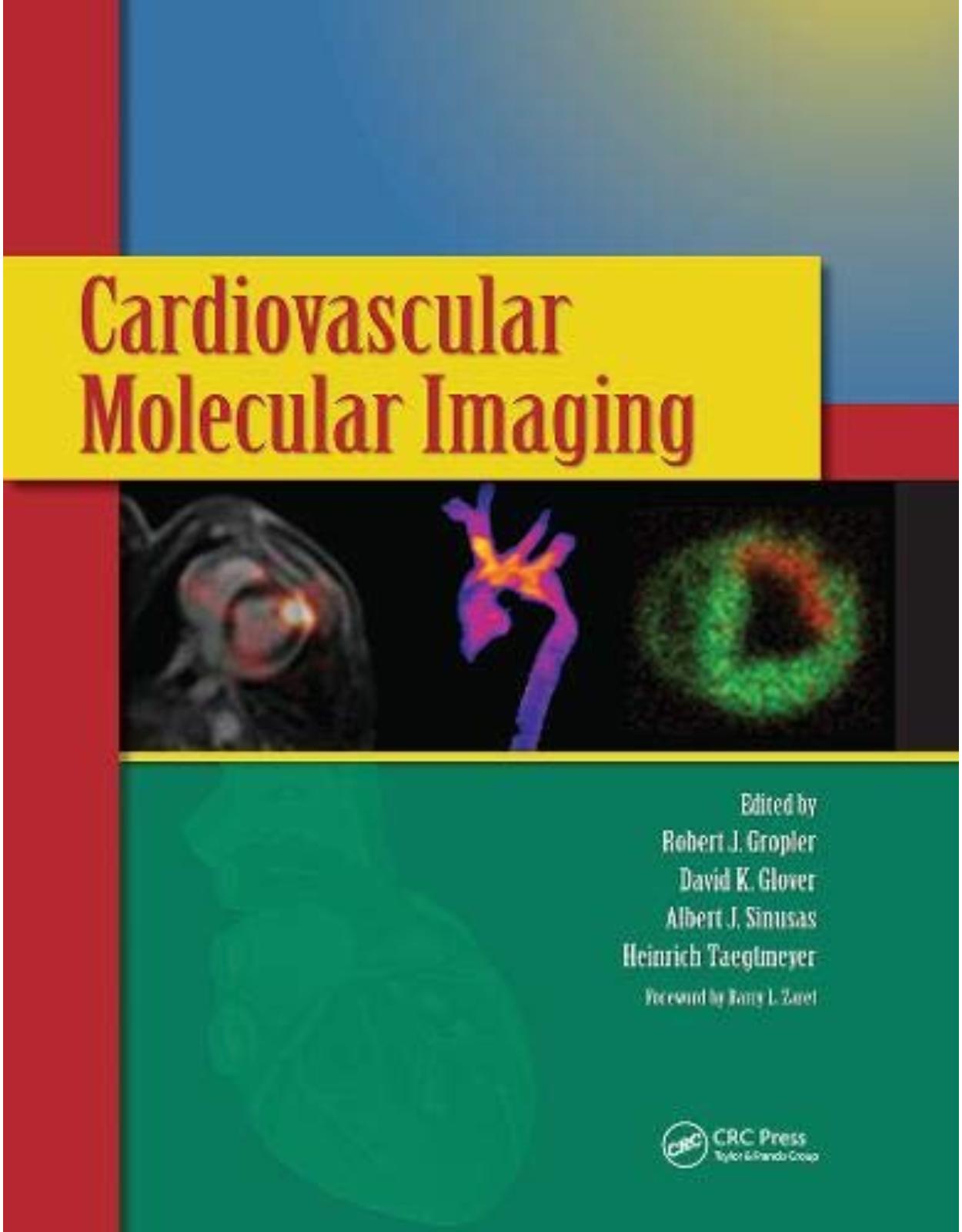 Cardiovascular Molecular Imaging 