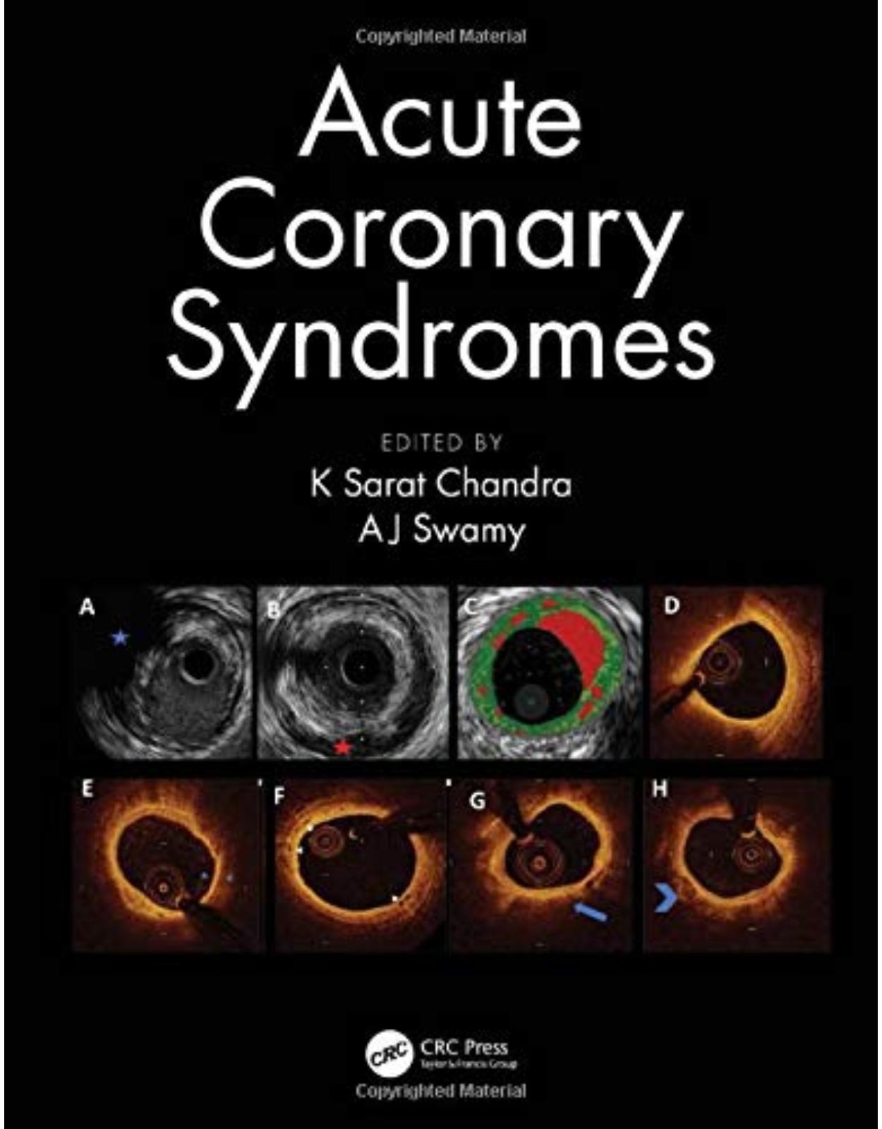 Acute Coronary Syndromes