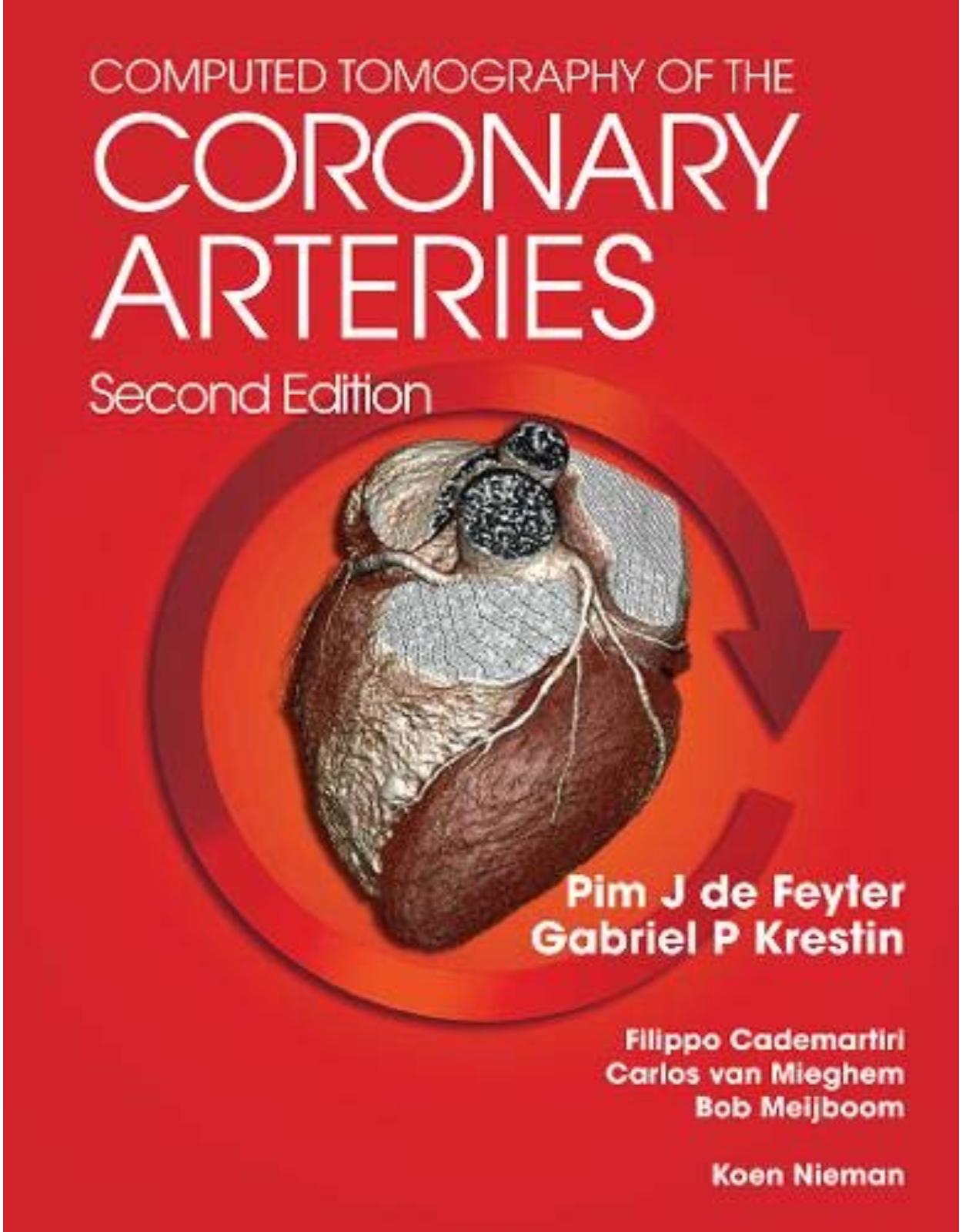 Computed Tomography of the Coronary Arteries