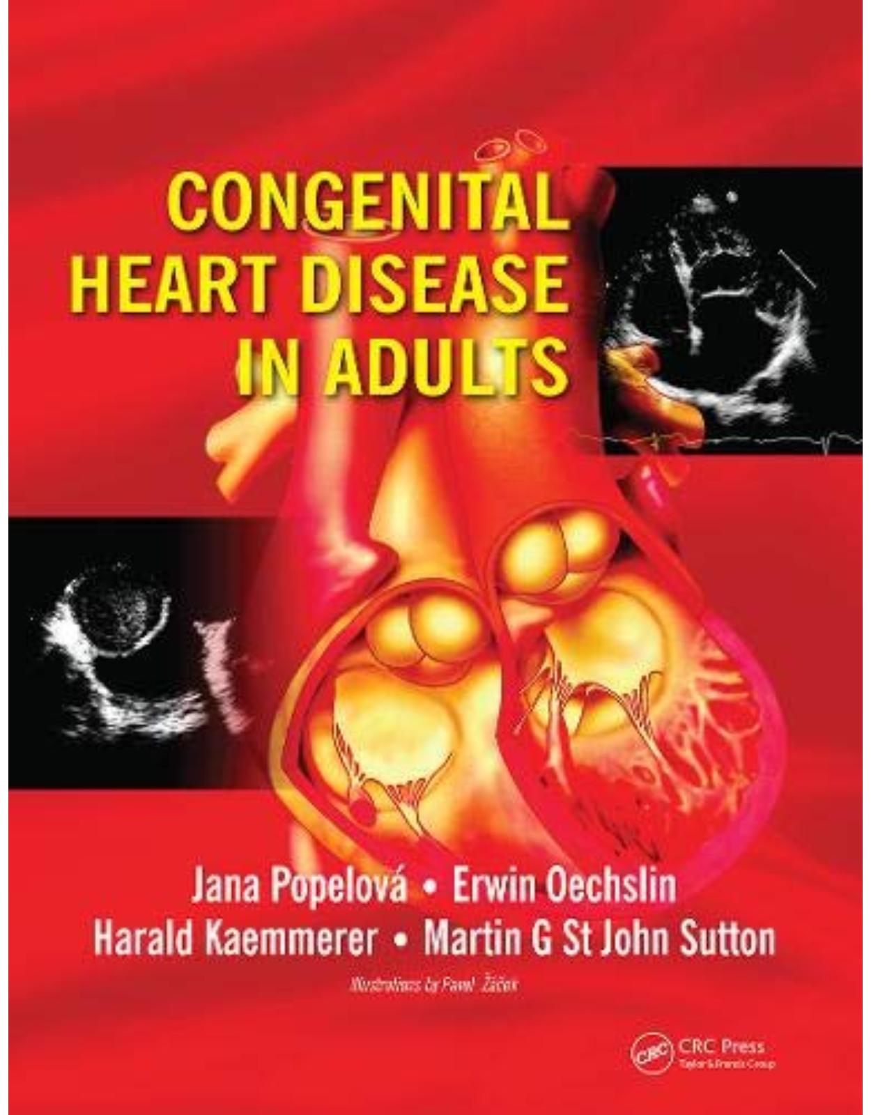 Congenital Heart Disease in Adults