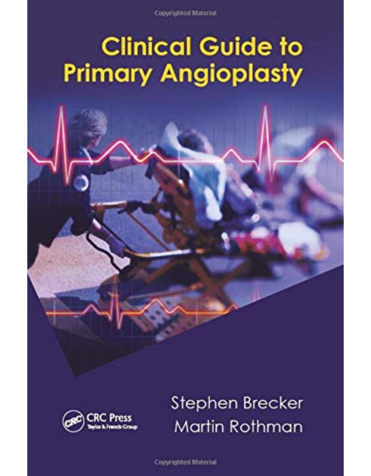 Clinical Guide to Primary Angioplasty